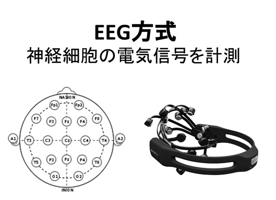 neuro_research図